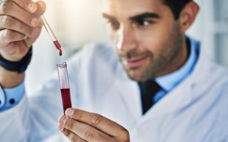 The Ultimate Guide to Understanding MCV Blood Test Results