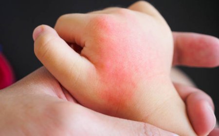 When to Worry About a Rash on Your Toddler - Eblogazine