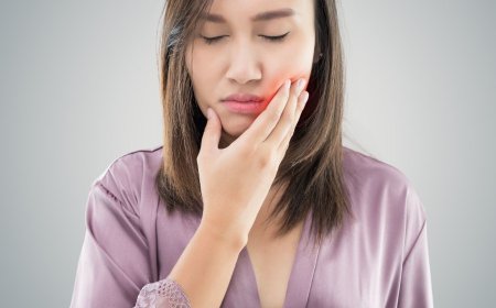 Canker Sores: What Are They and How to Prevent Them?